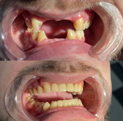 Улыбайтесь чаще! Стоматология «SMILE FOR YOU» дарит скидку до 40%